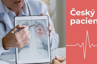 Třetí nejčastější důvod úmrtí. Pacientů jsou statisíce, o nemoci plic ani nevědí - Seznam Zprávy